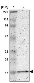 Lane 1: Marker [kDa] 220, 112, 84, 47, 32, 26, 17_br/_Lane 2: Human cell line RT-4