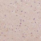 Immunohistochemical staining of human cerebral cortex shows moderate cytoplasmic positivity in glial cells.