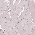 Immunohistochemical staining of human skeletal muscle shows no positivity in myocytes as expected.