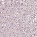 Immunohistochemical staining of human liver shows no positivity in hepatocytes as expected.