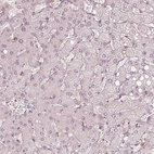 Immunohistochemical staining of human liver shows no positivity in hepatocytes as expected.