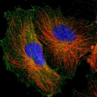 Immunofluorescent staining of human cell line U-251 MG shows localization to plasma membrane & cytosol.