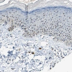 Immunohistochemical staining of human skin shows strong positivity in nucleoli in epidermal cells.