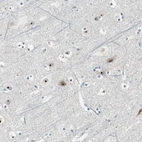 Immunohistochemical staining of human cerebral cortex shows strong positivity in nucleoli in neurons.