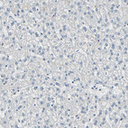 Anti-MYBBP1A Antibody