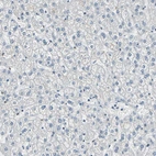 Immunohistochemical staining of human liver shows no positivity in nucleoli in hepatocytes as expected.