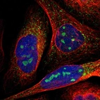 Immunofluorescent staining of human cell line U-2 OS shows positivity in nucleoli & vesicles.
