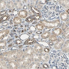Immunohistochemical staining of human kidney shows strong granular cytoplasmic positivity in a subset of renal tubules.