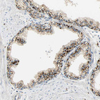 Anti-ASAH1 Antibody