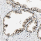 Immunohistochemical staining of human prostate shows strong granular cytoplasmic positivity in glandular cells.