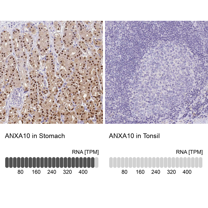 Anti-ANXA10 Antibody