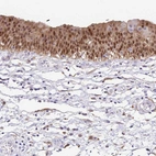 Immunohistochemical staining of human urinary bladder shows moderate nuclear positivity in urothelial cells.
