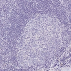 Immunohistochemical staining of human tonsil shows no positivity as expected.