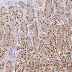 Immunohistochemical staining of human stomach shows moderate to strong nuclear positivity in glandular cells.