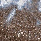 Anti-LANCL3 Antibody