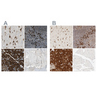 Anti-SYVN1 Antibody