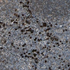 Immunohistochemical staining of human tonsil shows strong cytoplasmic positivity in non-germinal center cells.