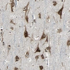 Immunohistochemical staining of human cerebral cortex shows strong cytoplasmic positivity in neurons.