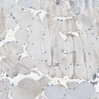 Immunohistochemical staining of human skeletal muscle shows no positivity in myocytes as expected.