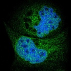 Immunofluorescent staining of human cell line A-431 shows localization to nucleoplasm & endoplasmic reticulum.