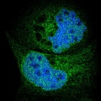 Anti-SYVN1 Antibody