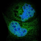 Immunofluorescent staining of human cell line A-431 shows localization to nucleoplasm & endoplasmic reticulum.