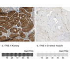 Anti-IL17RB Antibody