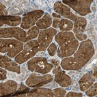 Immunohistochemical staining of human kidney shows strong cytoplasmic positivity in cells in tubules.