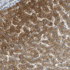 Immunohistochemical staining of human liver shows strong cytoplasmic and membranous positivity in hepatocytes.