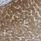 Immunohistochemical staining of human liver shows strong cytoplasmic and membranous positivity in hepatocytes.
