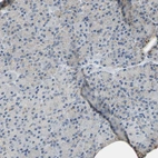 Immunohistochemical staining of human pancreas shows no positivity in exocrine glandular cells as expected.