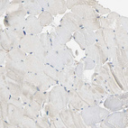 Immunohistochemical staining of human skeletal muscle shows no positivity in myocytes as expected.
