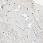 Immunohistochemical staining of human skeletal muscle shows no positivity in myocytes as expected.