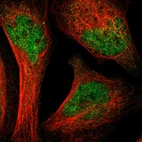 Immunofluorescent staining of human cell line U-2 OS shows localization to nucleoplasm.