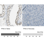 Anti-TPX2 Antibody