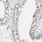 Immunohistochemical staining of human testis shows moderate nuclear positivity in cells in seminiferous ducts.