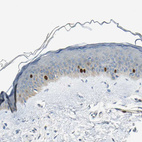 Immunohistochemical staining of human skin shows strong nuclear positivity in basal cells.