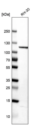 Western blot analysis in human cell line RH-30.