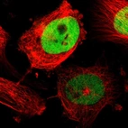 Immunofluorescent staining of human cell line U-251 MG shows localization to nucleoplasm.