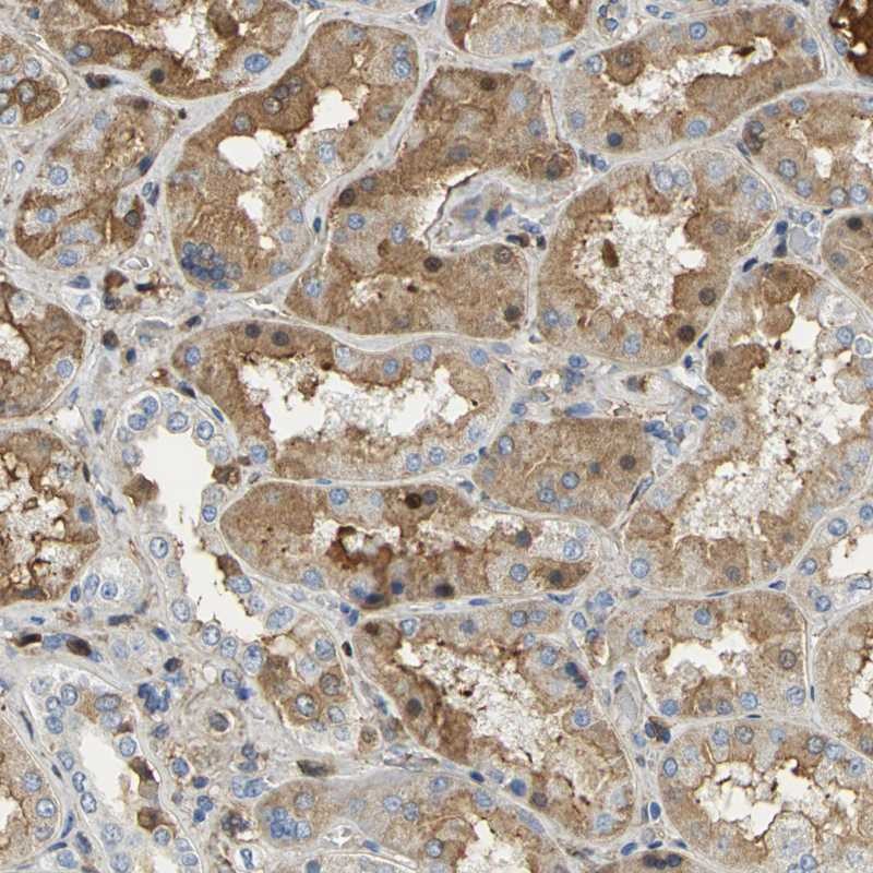 Anti-GYG2 Antibody