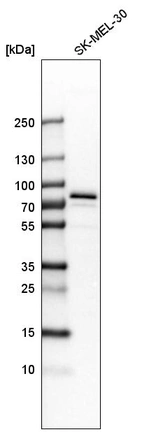 Western blot analysis in human cell line SK-MEL-30.
