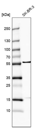 Anti-FRMD8 Antibody