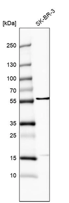 Anti-FRMD8 Antibody