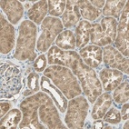 Anti-BIRC2 Antibody