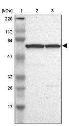 Lane 1: Marker [kDa] 220, 112, 84, 47, 32, 26, 17_br/_Lane 2: Human cell line RT-4_br/_Lane 3: Human cell line U-251MG sp