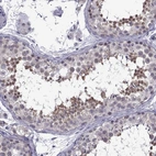 Immunohistochemical staining of human testis shows high expression.