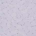 Immunohistochemical staining of human skeletal muscle shows low expression as expected.