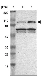 Lane 1: Marker [kDa] 220, 112, 84, 47, 32, 26, 17_br/_Lane 2: Human cell line RT-4_br/_Lane 3: Human cell line U-251MG sp