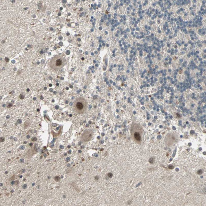 Anti-ZNF701 Antibody