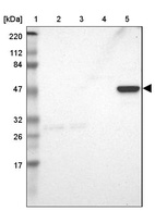 Lane 1: Marker [kDa] 220, 112, 84, 47, 32, 26, 17_br/_Lane 2: Human cell line RT-4_br/_Lane 3: Human cell line U-251MG sp_br/_Lane 4: Human plasma (IgG/HSA depleted)_br/_Lane 5: Human liver tissue